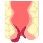 Medico Gastroenterólogo en León