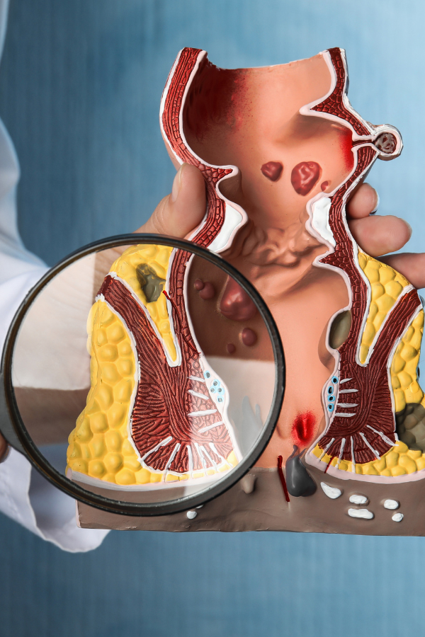 Cirugía Proctológica Servicios de Gastroenterología en Hospital Muguerza