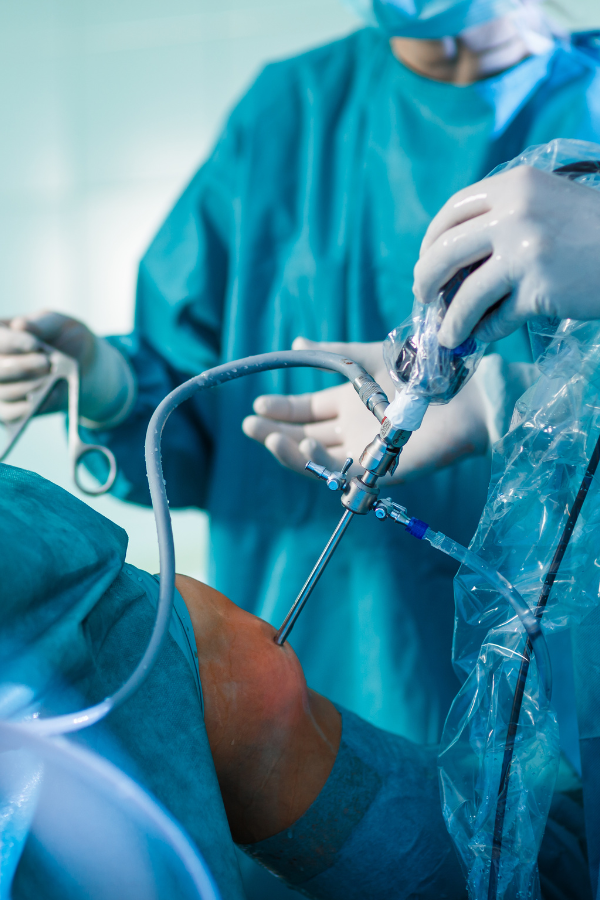 Manga gástrica. Servicios de Gastroenterología en Hospital Muguerza
