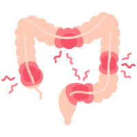 Obstrucción intestinal Cirugía Asistida por Robot en León