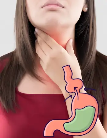 Padecimiento-Hernia-Hiatal Cirugía de Hernia Hiatal en Léon