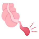 Cirugía Gastrointestinal de Urgencia en León