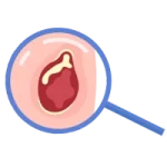 Cirugía Gastrointestinal de Urgencia en León