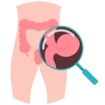 Cirugía Gastrointestinal de Urgencia en León