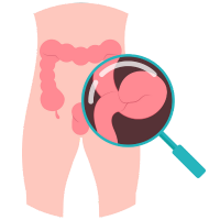 médico de Hernias médico de Hernias