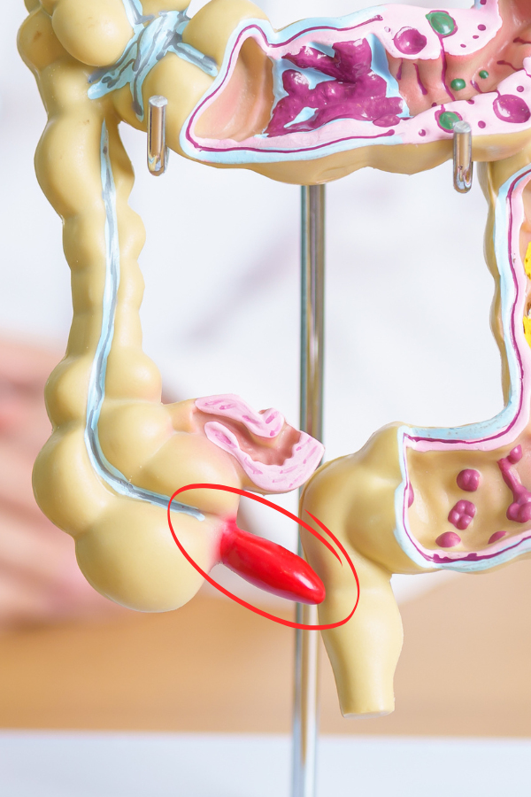 operacion de apendice Servicios de Gastroenterología en Hospital Muguerza